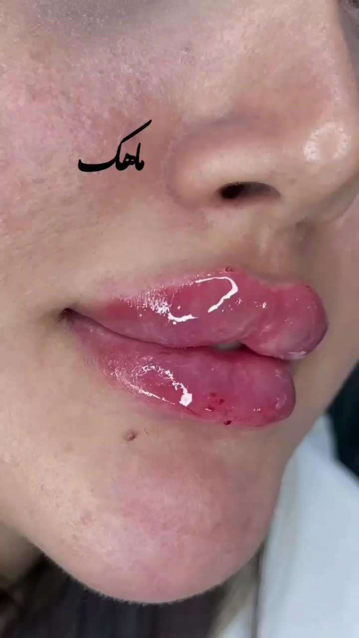 جشنواره ژل و بوتاکس فقط ۳۹۰ تومان|خدمات آرایشگری و زیبایی|شیراز, انجیر|دیوار