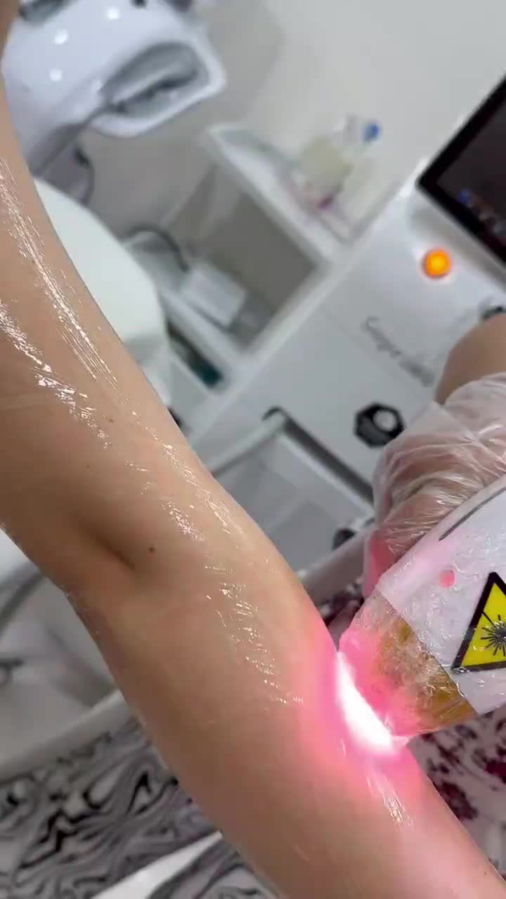 لیزر موهای زائد به صورت دائم با بهترین دستگاه لیزر|خدمات آرایشگری و زیبایی|کرمانشاه, |دیوار