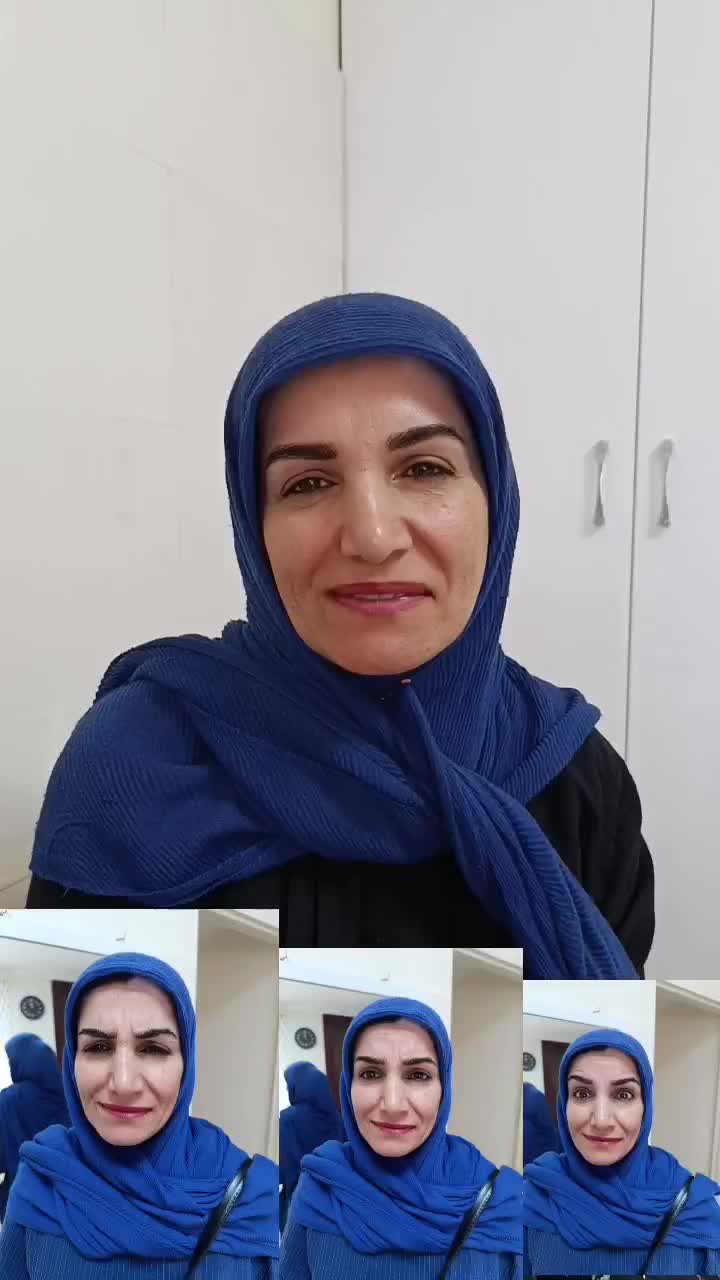 بوتاکس چشم گربه ای|خدمات آرایشگری و زیبایی|تهران, سازمان برنامه شمالی|دیوار