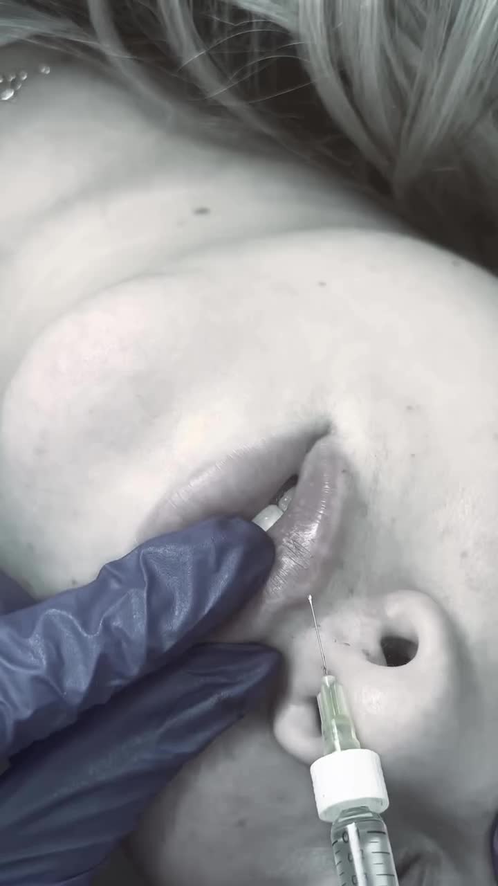 فیلر لب/کانتورینگ کامل صورت /فیلر بکینی/بوتاکس|خدمات آرایشگری و زیبایی|اصفهان, گلزار|دیوار