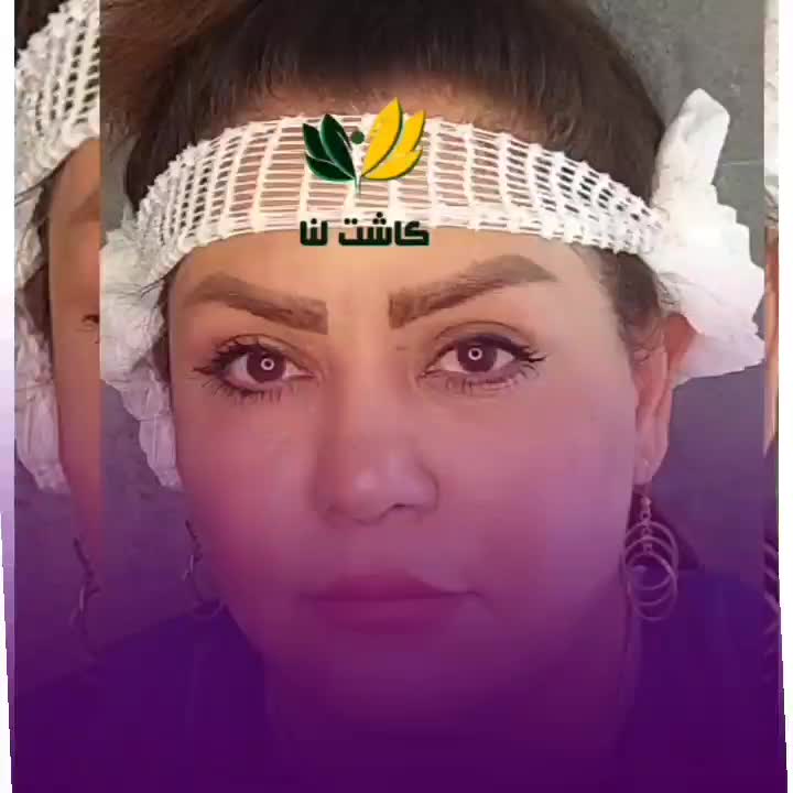 کاشت ابرو بلفاروپلاستی فقط ۸۷۰۰ میکرو کاشت|خدمات آرایشگری و زیبایی|تهران, پونک|دیوار