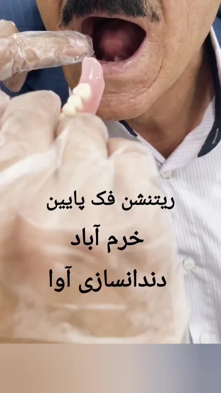 دندانسازی آوا قرارداد مستقیم کلیه بیمه ها|خدمات آرایشگری و زیبایی|خرم‌آباد, |دیوار