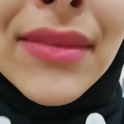 لمینت متحرک دندان|آرایشی، بهداشتی، درمانی|سنندج, |دیوار