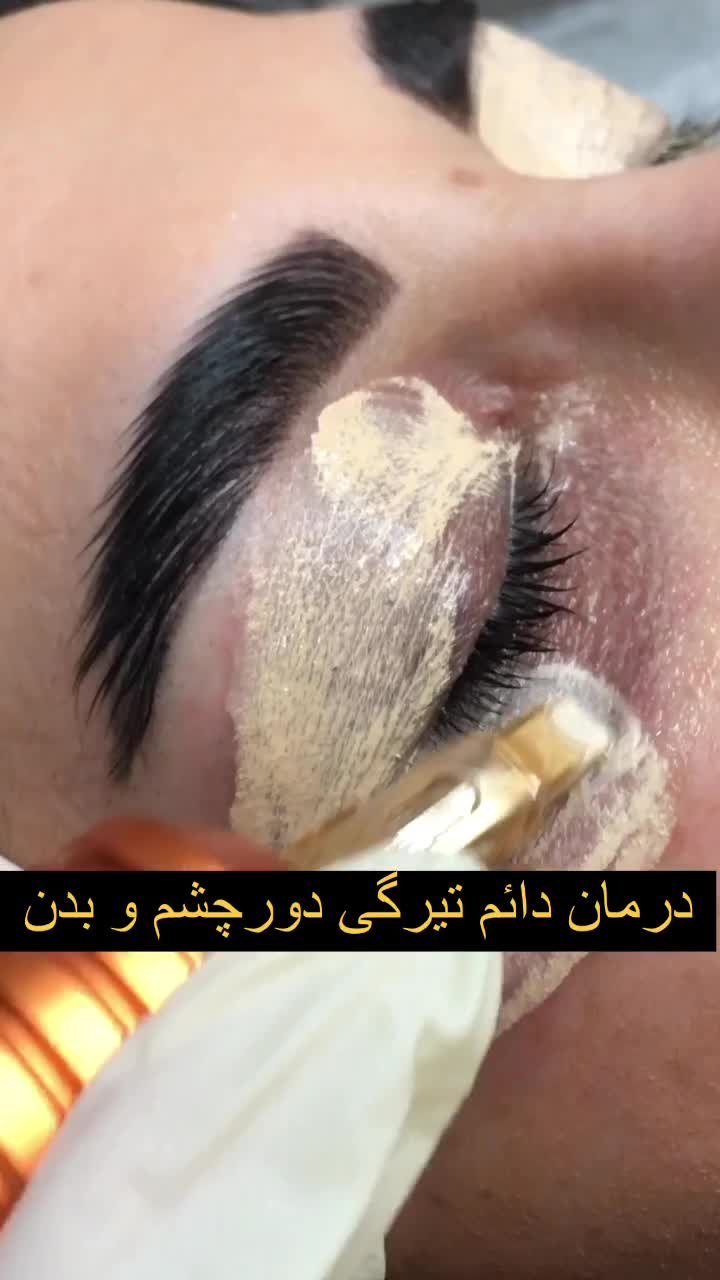 آموزش پوست شیشه ای( مجازی) محو پیسی|خدمات آموزشی|تهران, امیرآباد|دیوار