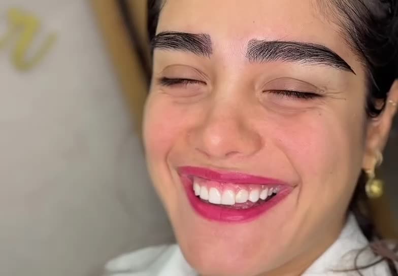 میکروکاشت با و بدون جراحی نقد و اقساط|خدمات آرایشگری و زیبایی|یاسوج, |دیوار