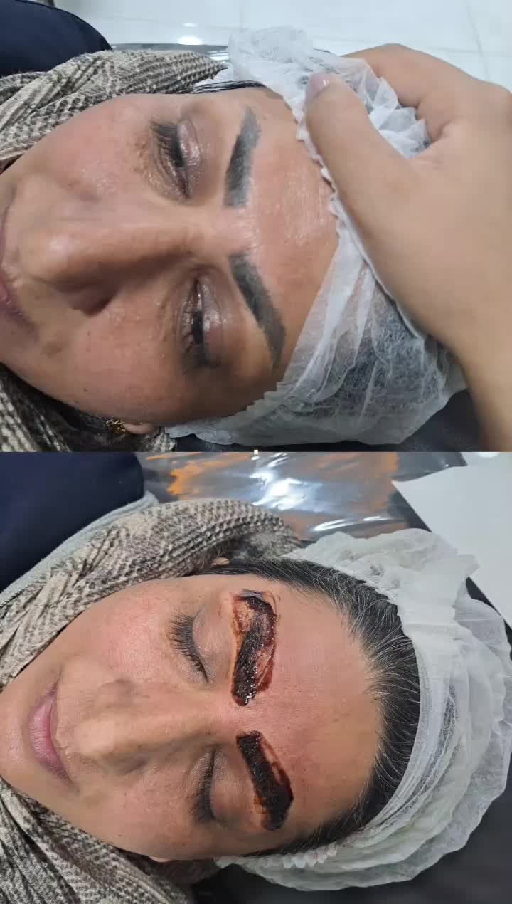 اموزش و خدمات ریموو تک جلسه ای با ض.م.ا.ن.ت|خدمات آرایشگری و زیبایی|کرمان, |دیوار