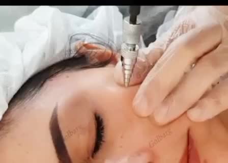 ژل،بوتاکس، لیزرخال و تاتو،ریمور|خدمات آرایشگری و زیبایی|قم, نیروگاه|دیوار