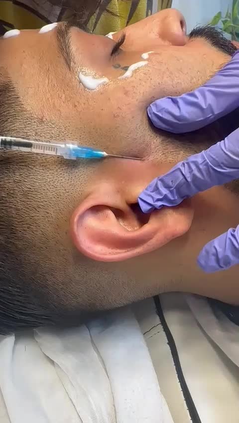 تزریق ژل و بوتاکس،ارایش دائم صورت(تاتو کل صورت)|خدمات آرایشگری و زیبایی|آزادشهر, |دیوار