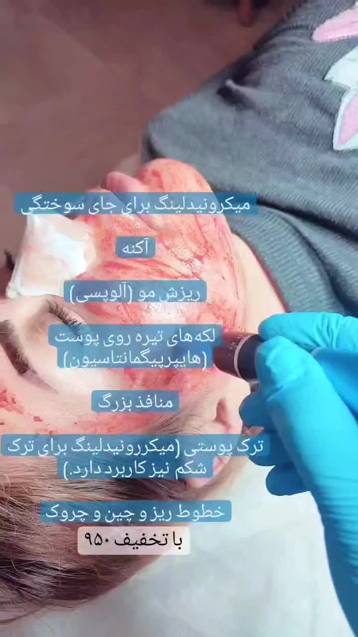 پاکسازی و فشیال پوست|خدمات آرایشگری و زیبایی|تهران, گیشا|دیوار