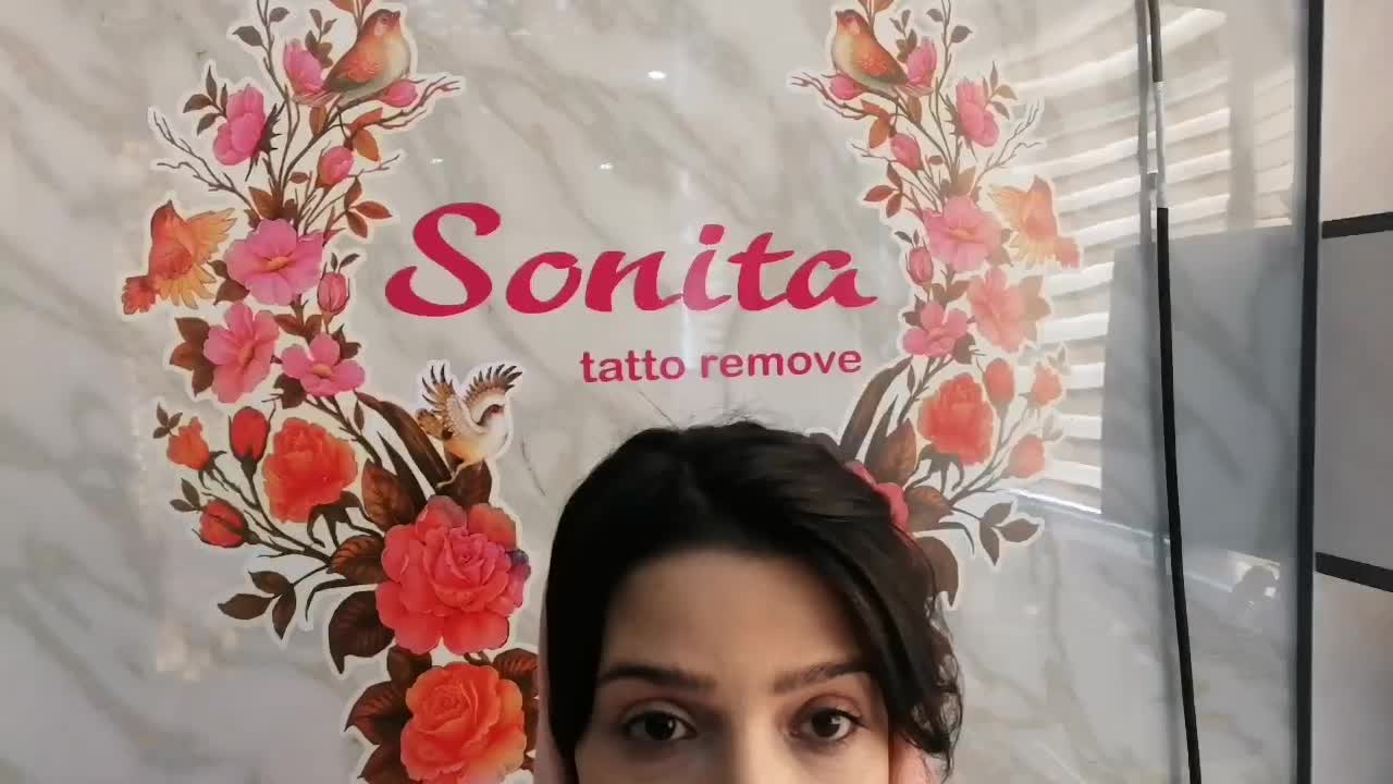 ریموو(پاک کردن تاتو) صورت وبدن با لیزر پیشرفته|خدمات آرایشگری و زیبایی|تبریز, |دیوار