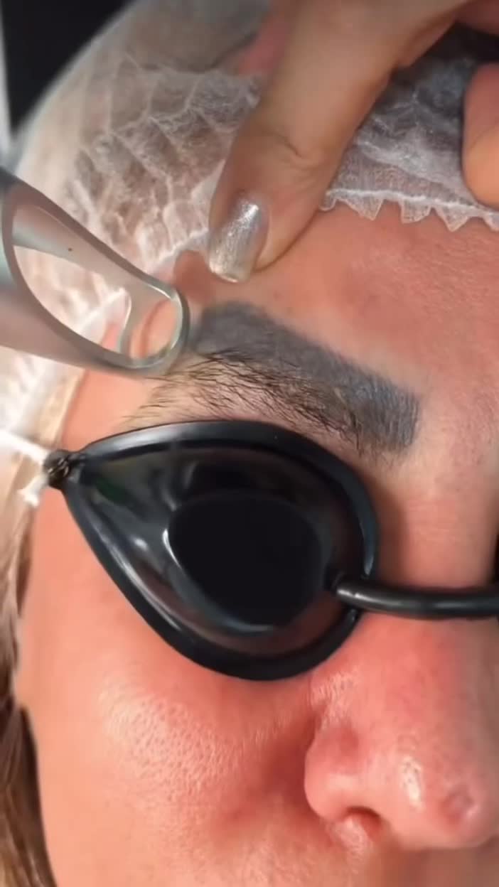 لیزر لک کک و مک و رفع تتو ولیزرموهای زاید|خدمات آرایشگری و زیبایی|نسیمشهر, |دیوار