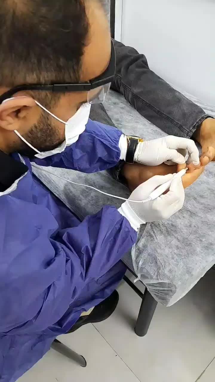 جراحی خال زگیل و میخچه و ناخن با لیزر در مطب پزشک|خدمات آرایشگری و زیبایی|قم, میرزائیه|دیوار
