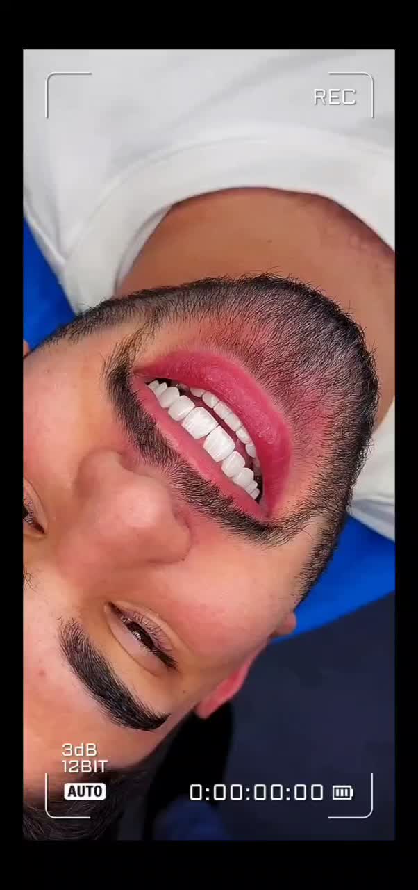 دندانپزشکی/عصبکشی/ترمیم/کامپوزیت/روکش شرق و غرب|خدمات زیبایی و سلامت|تهران, تهرانپارس شرقی|دیوار