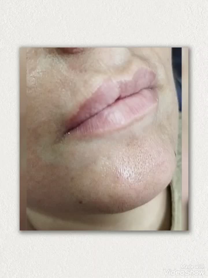 ژل و بوتاکس در منزل شما|خدمات آرایشگری و زیبایی|کرمانشاه, |دیوار