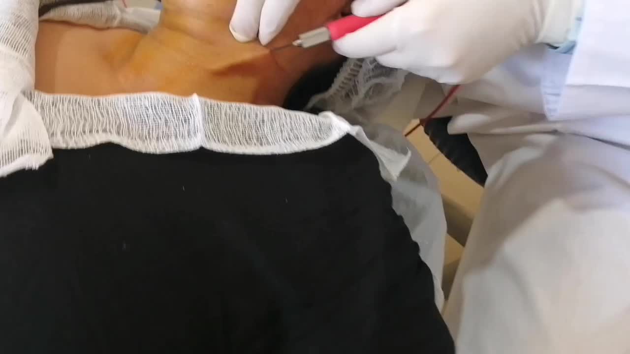 لیفت صورت و جوانسازی در یک جلسه|خدمات آرایشگری و زیبایی|شیراز, زند|دیوار