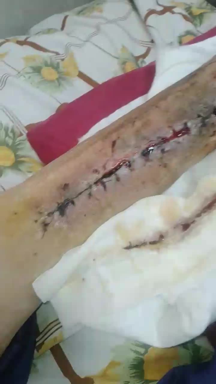 پرستار نگهدار همدم مراقب بیمار سالمند کودک و..|خدمات آرایشگری و زیبایی|گرگان, |دیوار