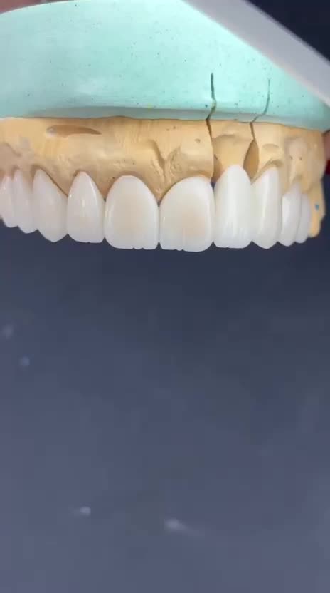 تخفیف ویژه ویژه ویژه روکش|خدمات آرایشگری و زیبایی|تهران, جوادیه|دیوار