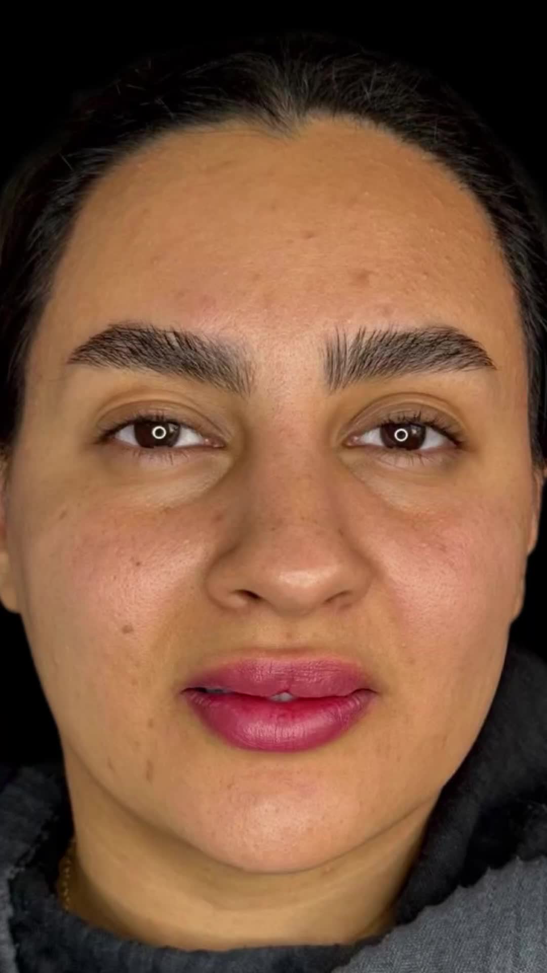 ۵۰ درصد تخفیف عمل جراحی بینی بدون تامپون با پیزو|خدمات آرایشگری و زیبایی|فردیس, طالقانی|دیوار