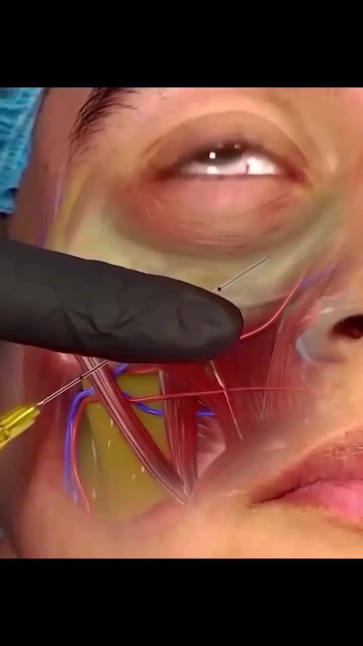 آموزش کاشت مو فیلر ژل بوتاکس نخ لیفت لیزر مو فشیال|خدمات آموزشی|اصفهان, ملک‌شهر|دیوار