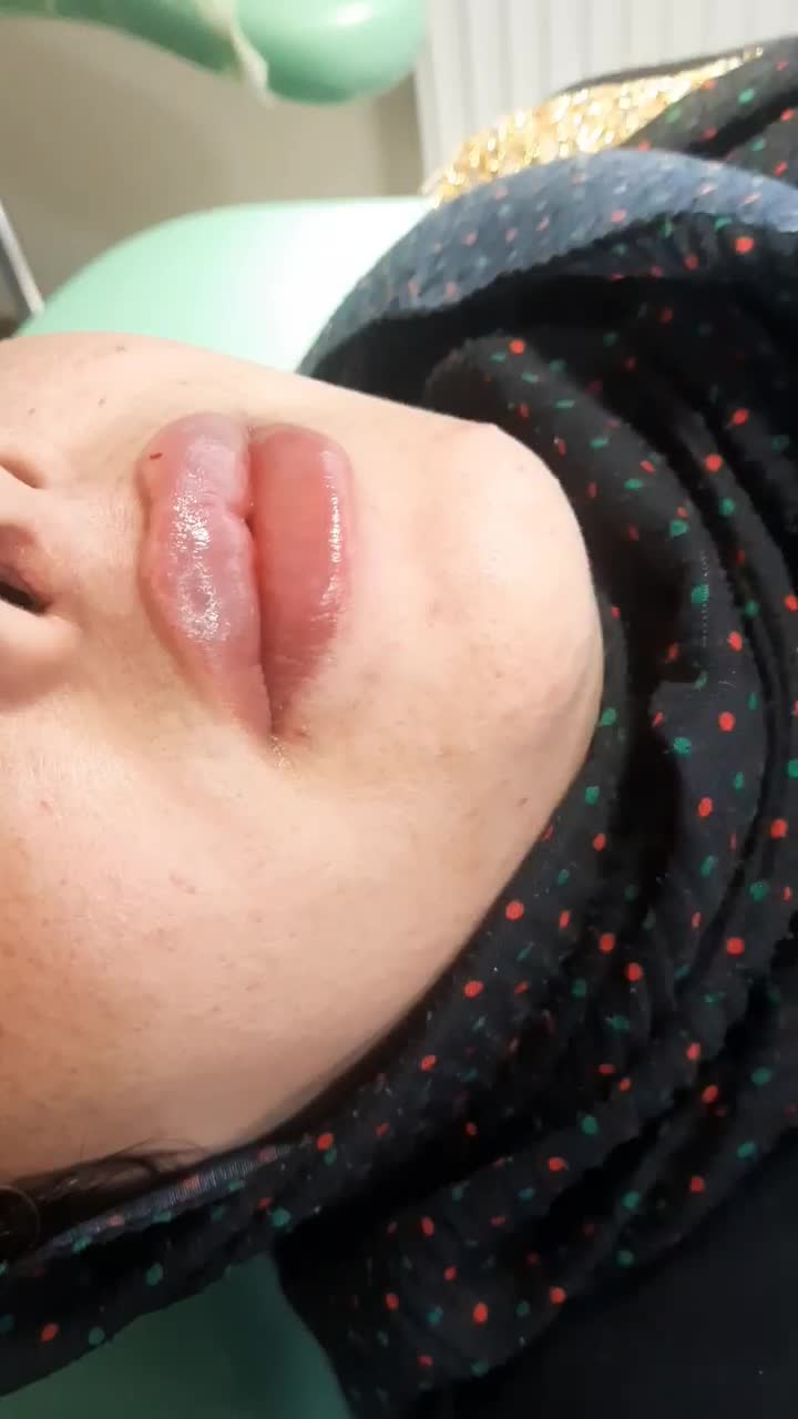 بوتاکس مصپورت فقط ۴۹۰ وفیلر ۵۹۰ پی ارپی ۸۵۰|خدمات آرایشگری و زیبایی|اصفهان, رزمندگان|دیوار