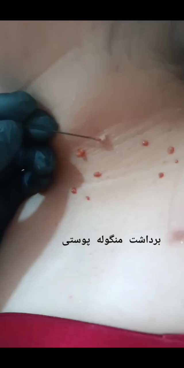 پوست ،زیبایی|خدمات آرایشگری و زیبایی|رباط‌کریم, الارد|دیوار