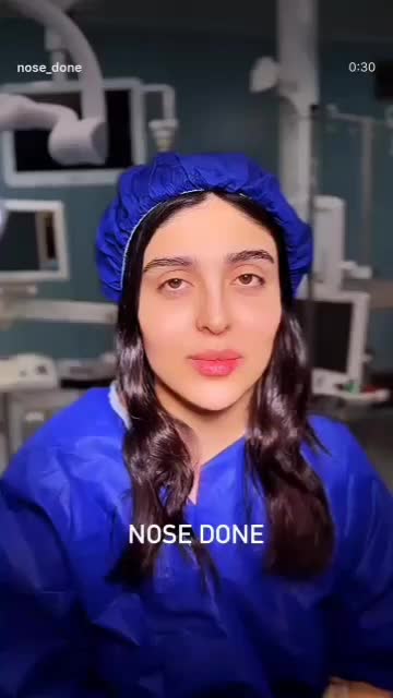 جراحی بینی ۲۹ میلیون فقط ۸ اذر|خدمات آرایشگری و زیبایی|قم, بکایی|دیوار