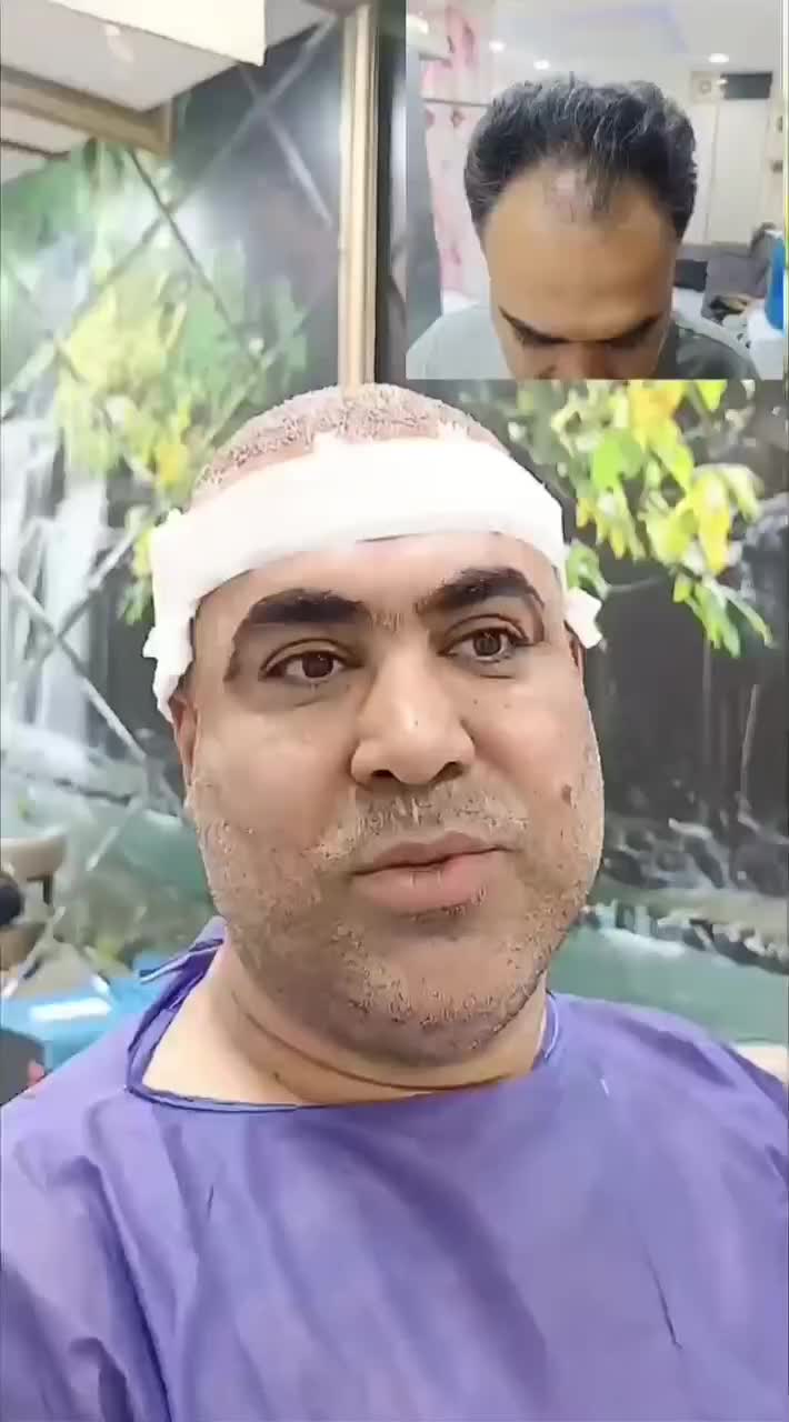 کاشت مو ابرو لیزر ژل بوتاکس مزو واکسن زگیل تناسلی|خدمات آرایشگری و زیبایی|اندیشه, اندیشه فاز ۱|دیوار