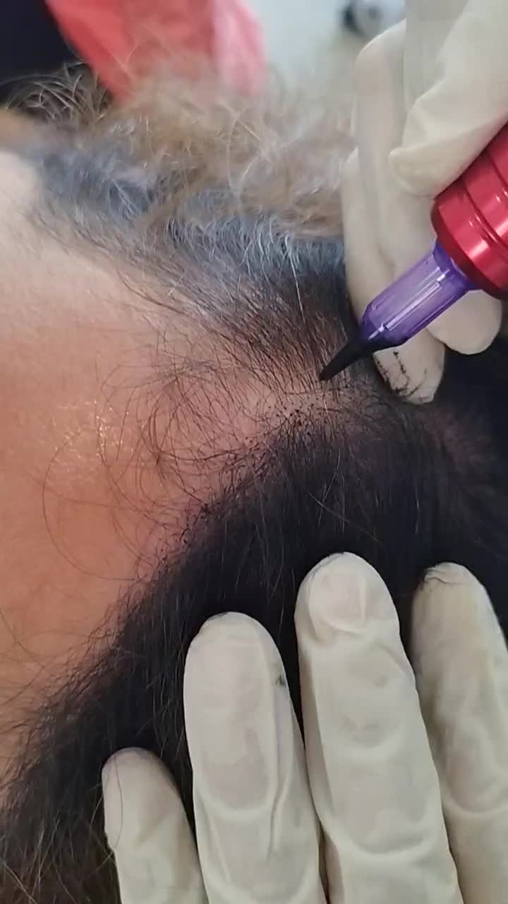 کم پشتی موهات با میکرواسکالپ، کبودی لبات با شیدینگ|خدمات آرایشگری و زیبایی|کاشان, مفتح|دیوار