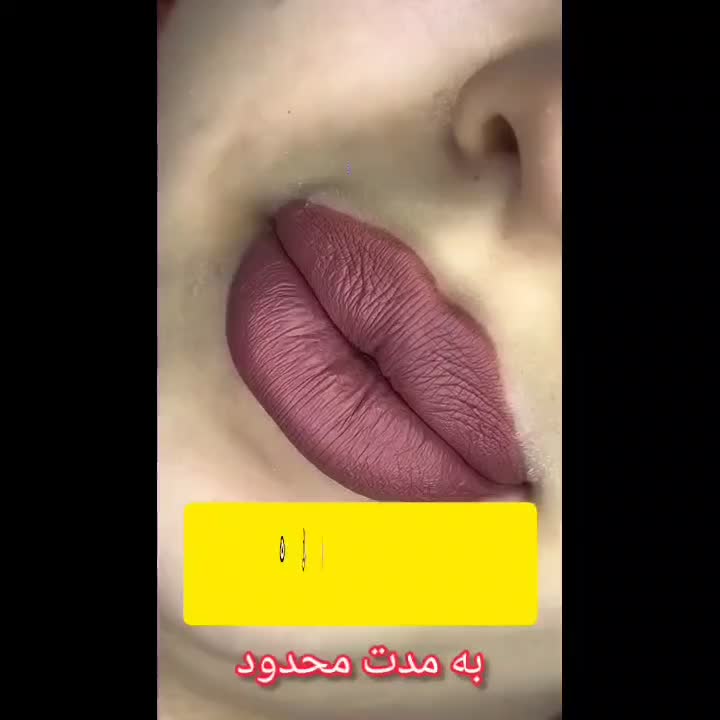 کامپوزیت دندان/لمینیت/دندانپزشکی/ترمیم/عصبکشی|خدمات آرایشگری و زیبایی|تهران, جردن|دیوار