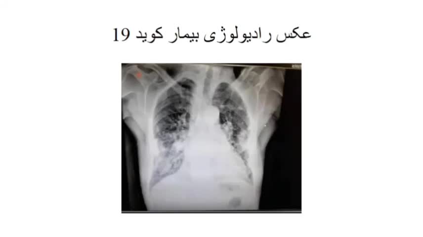 مشاوره پایان نامه رشته نرم افزار|خدمات آموزشی|بندرعباس, |دیوار