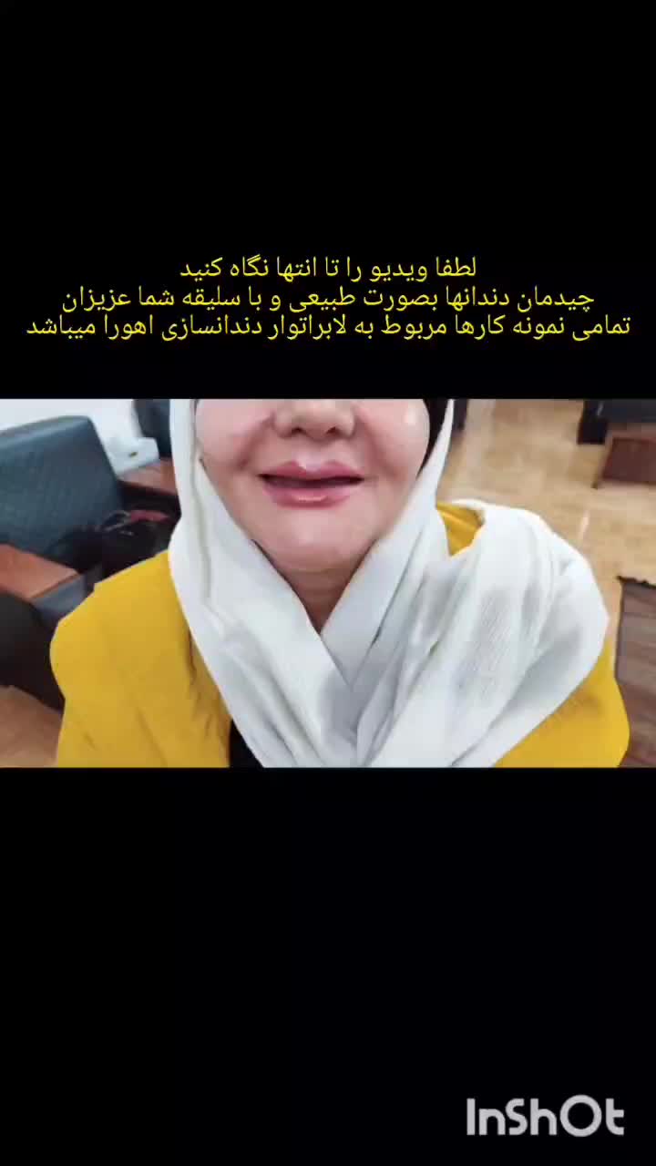 دندان ،دندان سازی ،دندان مصنوعی ،جوان پسند،اقساطی|خدمات آرایشگری و زیبایی|مشهد, شاهد (شهرک غرب)|دیوار