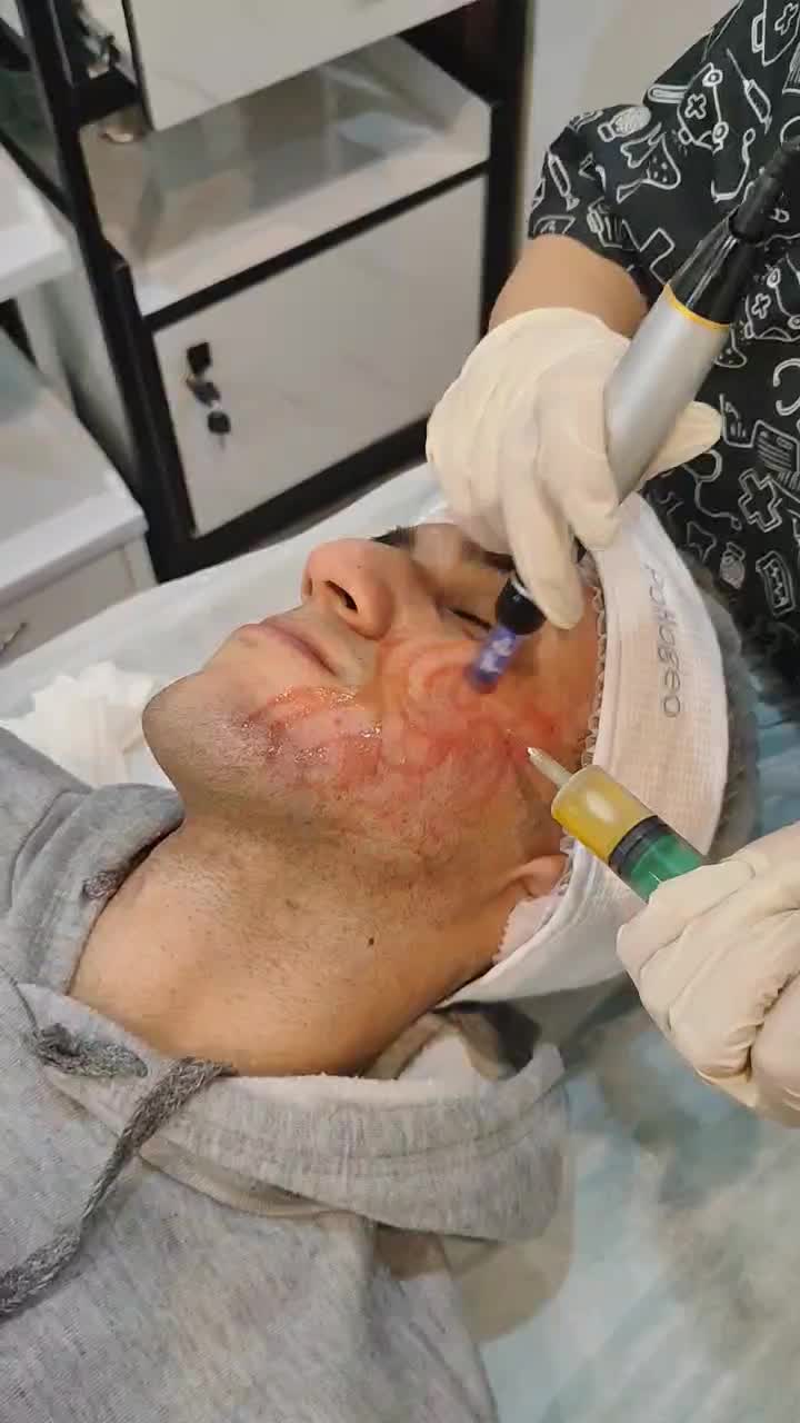 آموزش بوتاکس و پی ار پی|خدمات آموزشی|تهران, فلسطین (میدان انقلاب)|دیوار