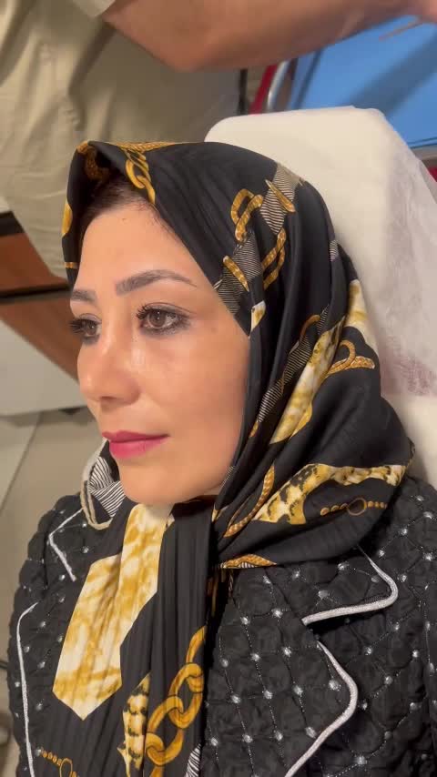 جشنواره تخفیفی لیپوماتیک بلفاروپلاستی و لیپوبازو|خدمات آرایشگری و زیبایی|تهران, ونک|دیوار