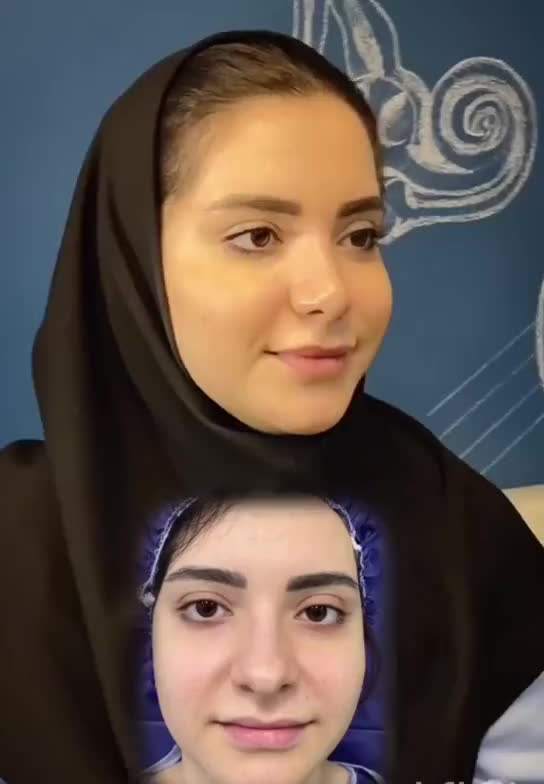 عمل جراحی بینی بامتخصص گوش،حلق،بینی|خدمات آرایشگری و زیبایی|تهران, یوسف‌آباد|دیوار