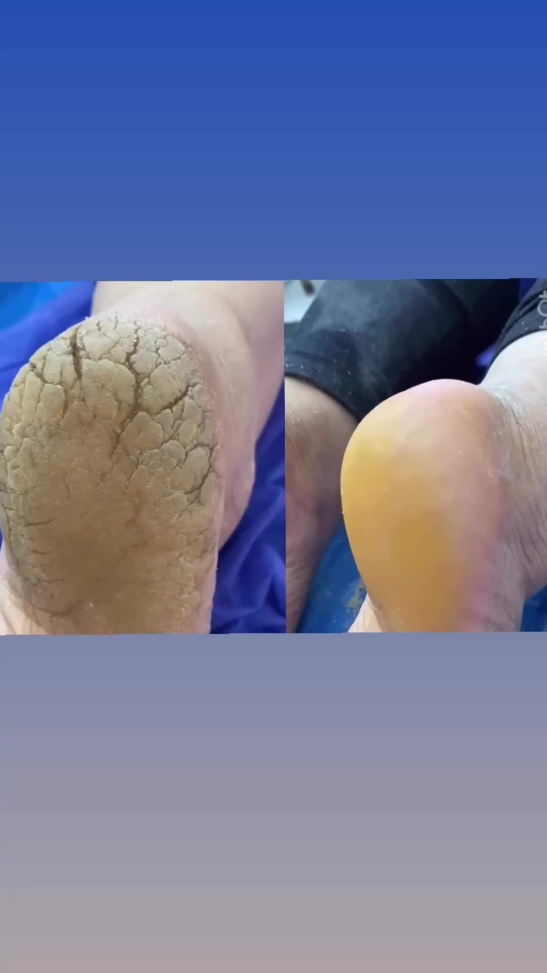 پدیکور تخصصی|خدمات آرایشگری و زیبایی|برازجان, |دیوار