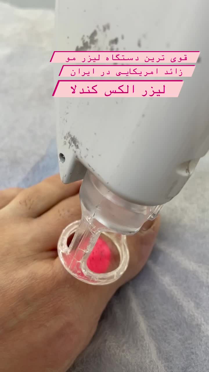 استخدام اپراتور لیزر کندلا در کلینیک معتبر|استخدام درمانی، زیبایی، بهداشتی|تهران, شاهین|دیوار