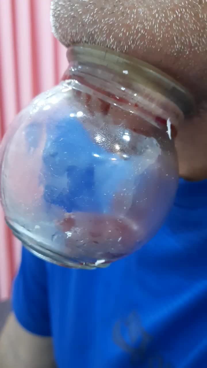 حجامت و بادکش گرم درمانی|خدمات آرایشگری و زیبایی|اصفهان, باغ فدک|دیوار