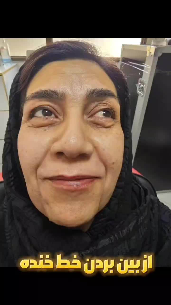 جشنواره تابستانه تزریق فیلروبوتاکس درکلینیک زیبایی|خدمات آرایشگری و زیبایی|اصفهان, وحید|دیوار