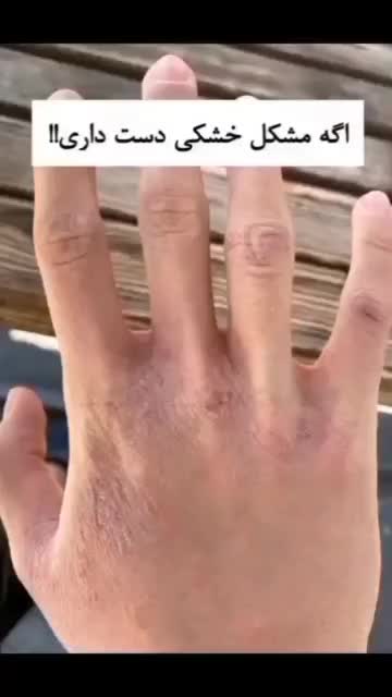 انواع کرم آبرسان ها|آرایشی، بهداشتی، درمانی|اردبیل, |دیوار