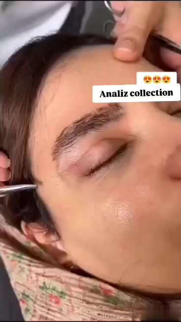 آفر ویژه عمل بینی پلک/کاشت مو/دندان/غبغب/لیپوابدو|خدمات آرایشگری و زیبایی|شیراز, معالی‌آباد|دیوار