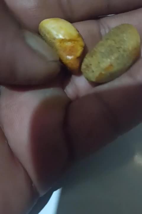 مهره|کلکسیون اشیاء عتیقه|اهواز, کمپلو جنوبی|دیوار