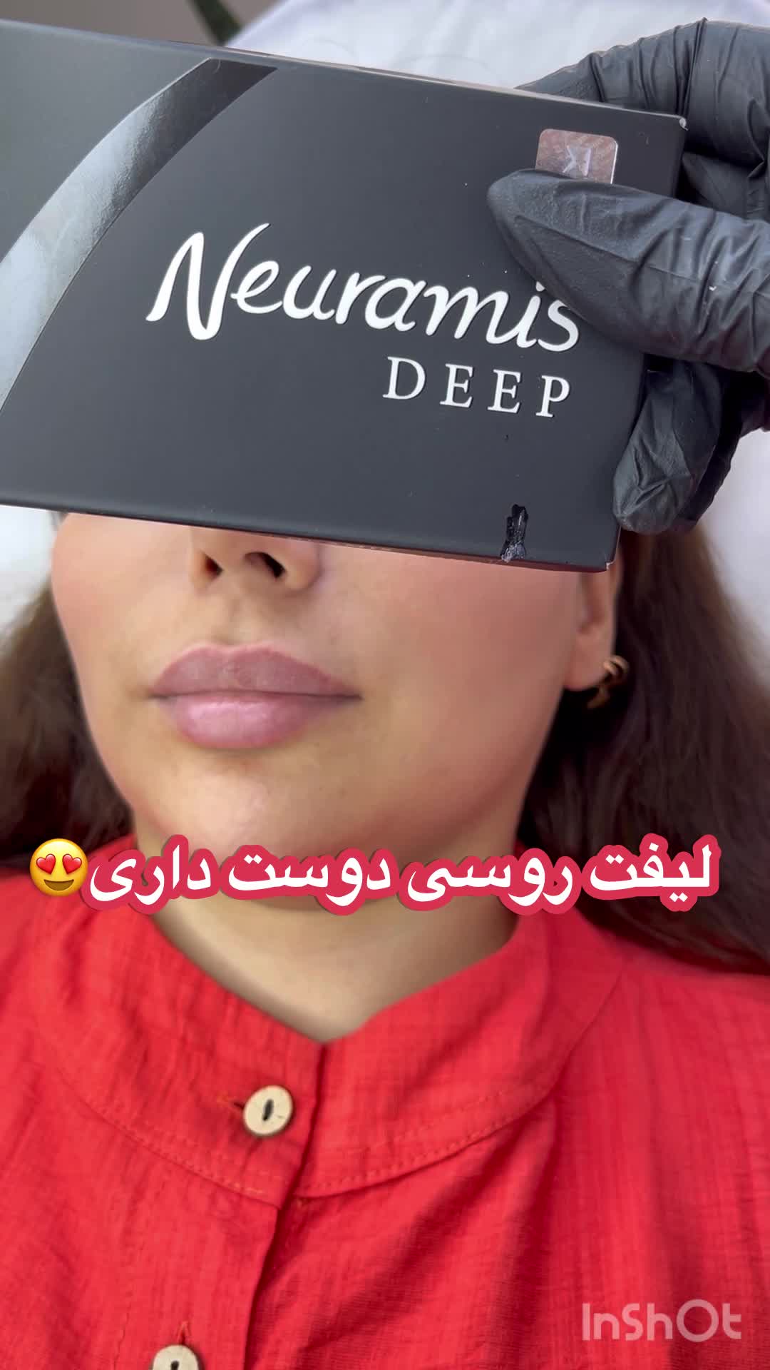 مدل تزریق ژل و بوتاکس کانتورینگ عربی ،لب روسی|خدمات آرایشگری و زیبایی|کرج, گوهردشت|دیوار