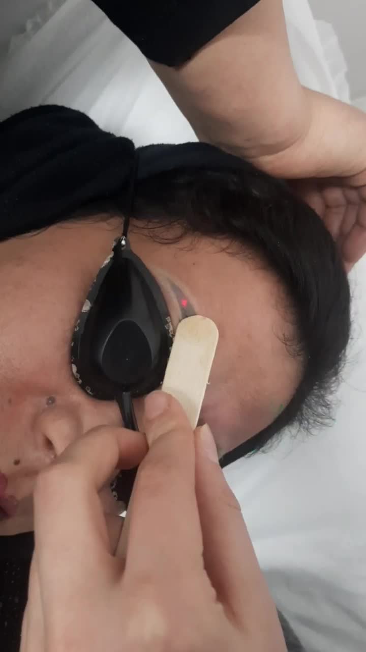 لیزر پاکسازی تتو روشن سازی تخصصی صورت و نواحی تیره|خدمات آرایشگری و زیبایی|قم, زنبیل آباد|دیوار
