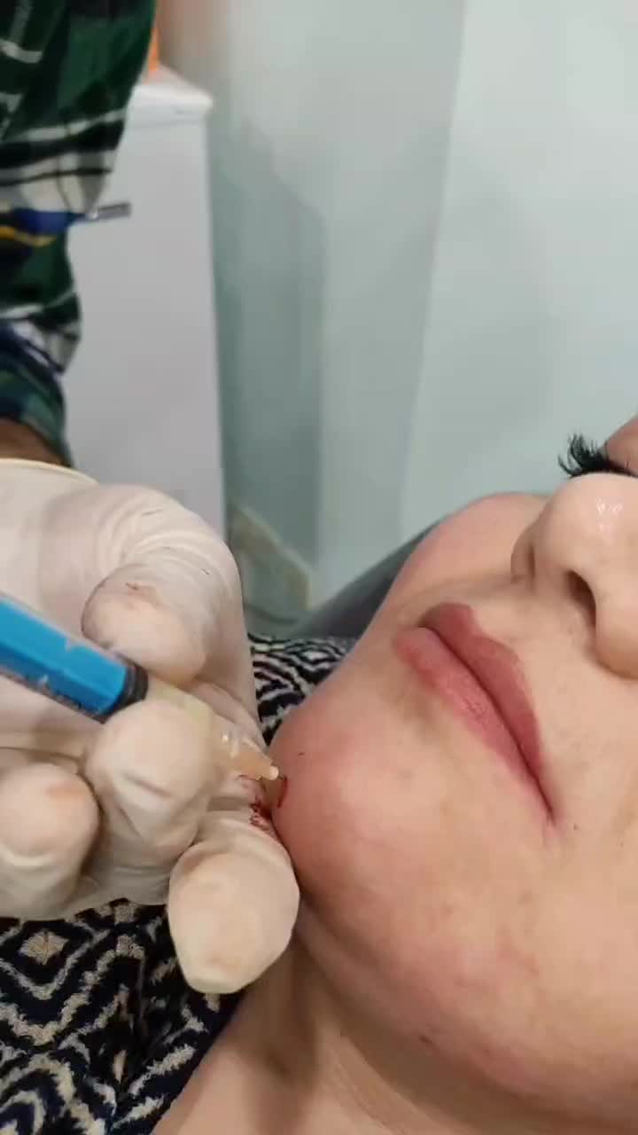 لیزر وزیبایی طلا|خدمات آرایشگری و زیبایی|سنندج, |دیوار