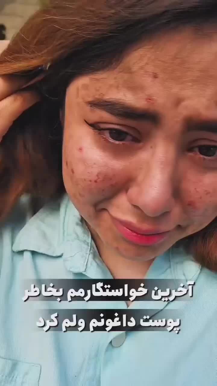 سرم مغذی لاکچری کوین تخفیف 30% بلک فرایدی|آرایشی، بهداشتی، درمانی|فردیس, خیام غربی|دیوار