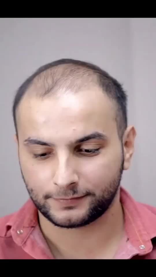 پروتز مو معجزه زیبایی|خدمات آرایشگری و زیبایی|اصفهان, ملک|دیوار