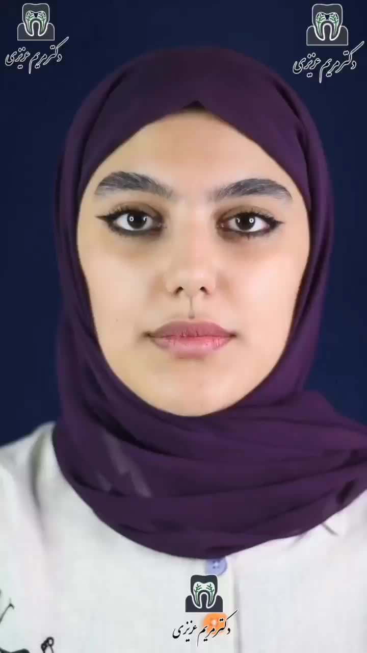 پایتخت لمینت کامپوزیت دندان ، خدمات دندانپزشکی|خدمات آرایشگری و زیبایی|شیراز, معالی‌آباد|دیوار