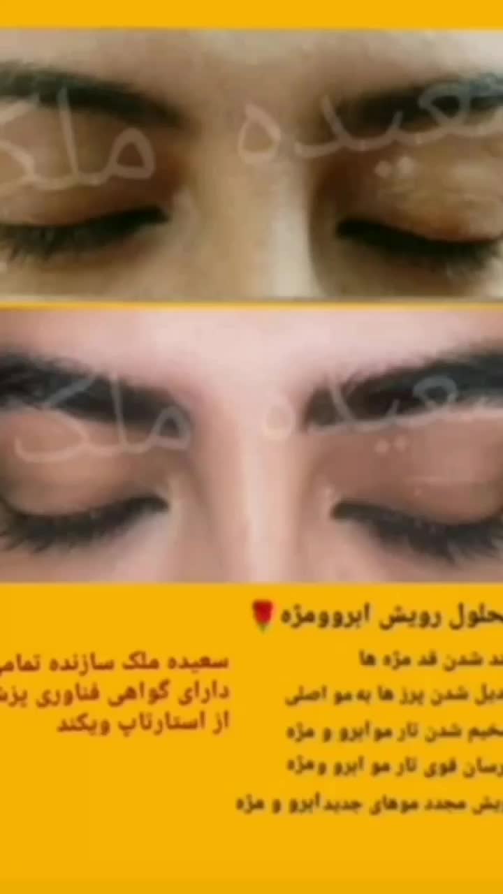 محلول رویش و رشد مجدد ابرو و مژه ملک|آرایشی، بهداشتی، درمانی|شاهرود, |دیوار