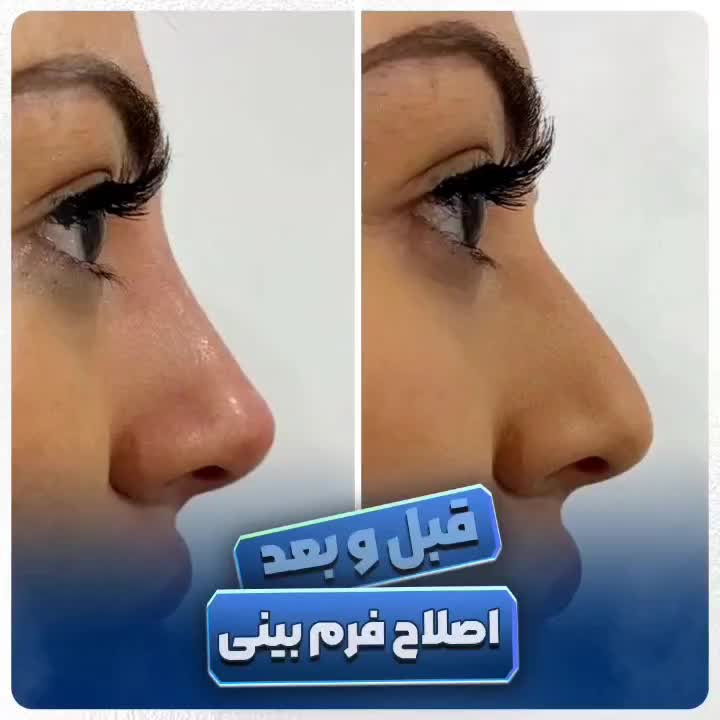 آف پکیج تخصصی FOX EYE پزشک پوست مو بینی زیبایی|خدمات آرایشگری و زیبایی|مشهد, هنرستان|دیوار
