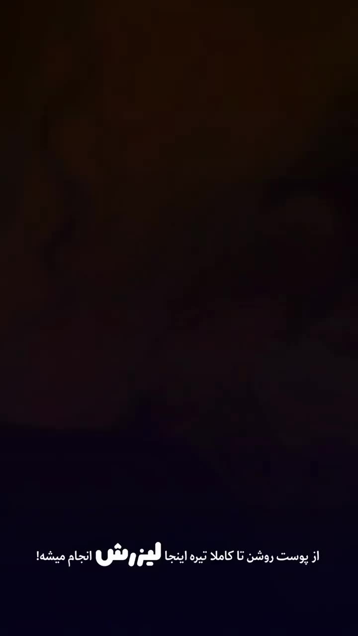 لیزر موهای زائد|خدمات آرایشگری و زیبایی|بندرعباس, |دیوار